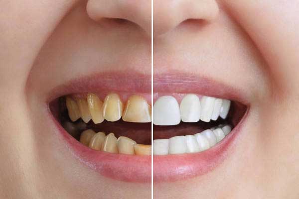 Cosmetic Procedures